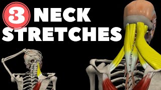 Neck Stretches for Instant pain relief [upl. by Damalus]