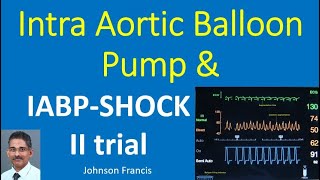 Intra Aortic Balloon Pump IABP and IABPSHOCK II trial [upl. by Em]