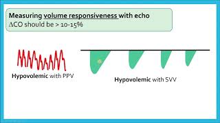 Assessing Cardiac Output and Volume Responsiveness  Critical Care Echo [upl. by Rivard]