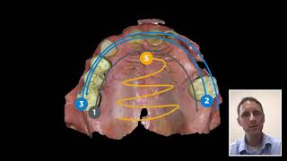 Intraoral scanning technique with Primescan Scan pattern for best accuracy [upl. by Trey27]