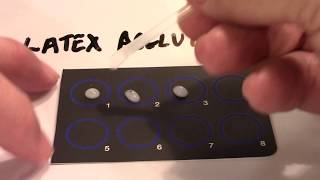 Latex Agglutination and Titer  Part 1 [upl. by Innek]