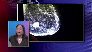 Mammogram Images [upl. by Llenral397]