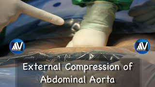 Abdominal Aorta Palpation [upl. by Ekal207]