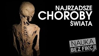 Najrzadsze choroby  Nauka BEZ fikcji 03 [upl. by Liberati]