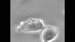 Introduction to Cancer Biology Part 1 Abnormal Signal Transduction [upl. by Einwat571]