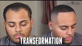 HAIRCUT TRANSFORMATION  Receding Hairline amp Widows Peak Tips HD [upl. by Esyli]