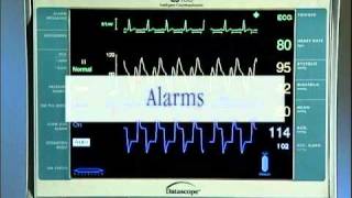 IntraAortic Balloon Catheter Tutorial English [upl. by Juliano]