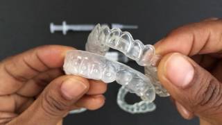 How to use Tooth Whitening Trays [upl. by Concoff]