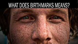 What does birthmarks means [upl. by Autrey]