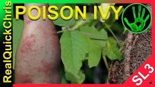 poison ivy rash identification and symptoms with treatment [upl. by Darton]