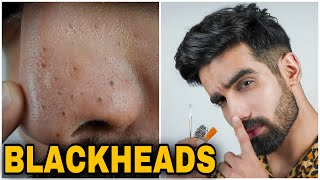 How To Remove BLACKHEADS at HomeEASY amp NATURALSkincare routineLarge Blackhead extraction Hindi [upl. by Aerdnac442]