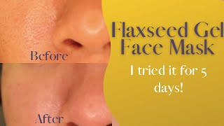 Flaxseed Gel Face Mask  I tried it for 5 days and this happened [upl. by Amy]