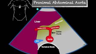 How to Scan the Aorta [upl. by Ennovoj]