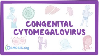 The Easy Way to Understand Congenital Heart Disease 🫀  Cardiology [upl. by Wernher286]