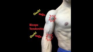 How to Relieve Shoulder Pain Using Myofascial Release Techniques [upl. by Star]