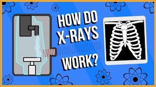 How do XRays Work [upl. by Yllier]