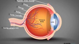 An Approach to a Red Eye [upl. by Bernadene]