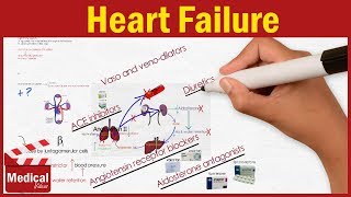 Pharmacology  Heart Failure Symptoms Causes and Treatment Options FROM A TO Z [upl. by Waverley]