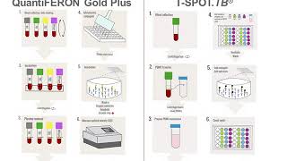 Interferon Gamma Release Assays IGRAs [upl. by Vallonia]