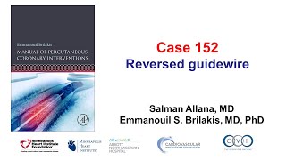 Case 152 PCI Manual  Reversed guidewire [upl. by Noryk728]