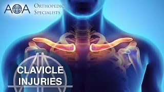 AOA Orthopedic Specialists  Clavicle Injuries [upl. by Niko311]