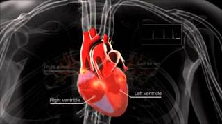 What is atrial fibrillation [upl. by Atteyek]