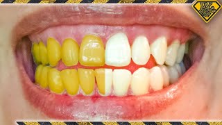 What Teeth Whitening Methods ACTUALLY Work [upl. by Adore761]