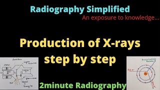 Production of Xrays l 2minute Radiography l Radiography Simplified l [upl. by Davy]