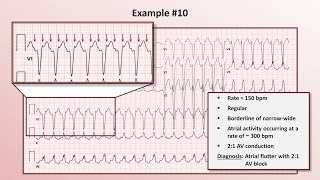 Intro to EKG Interpretation  Practicing Tachyarrhythmia Identification [upl. by Harbison]