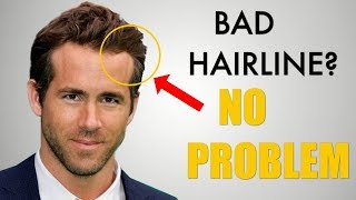 5 Awesome Hairstyles for Widows Peak  Receding Hairline [upl. by Talie]