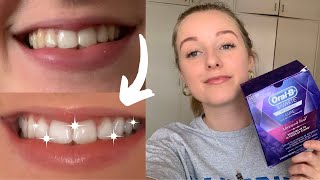 Oral B 3D White Whitestrips  Results Sensitivity [upl. by Alekal432]