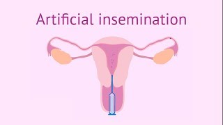 Artificial insemination [upl. by Symons]