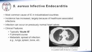 Endocarditis Microbiology and Treatment [upl. by Lemar]