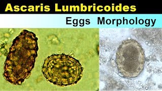 Ascaris lumbricoides eggs Morphology [upl. by Tarsus]