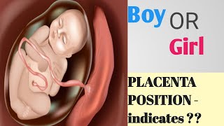 Placenta Positions During Pregnancy  Baby Gender Prediction  Anterior or Posterior Placenta [upl. by Mickey]