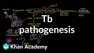 TB pathogenesis  Infectious diseases  NCLEXRN  Khan Academy [upl. by Yecniuq]