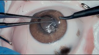 Cornea Suture 101 [upl. by Haukom]