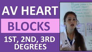 How to Interpret AV Heart Blocks Ekg Heart Rhythms  1st degree 2nd degree 3rd degree difference [upl. by Gar]