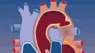 CT assessment  measuring aortic root [upl. by Pacificia645]