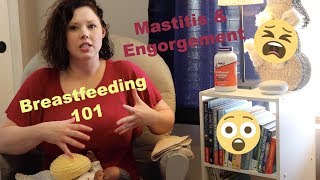 Mastitis and Engorgement  Lactation Consultant  Nurse Whit [upl. by Hugon]