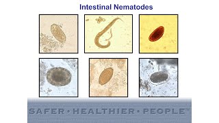 Diagnostic Features of Intestinal Nematodes [upl. by Aderfla725]