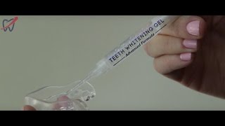 Teeth Whitening Syringe and Tray Instructions [upl. by Burrus807]