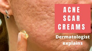 Acne Scar Creams  Dermatologist Reviews [upl. by Flanagan662]