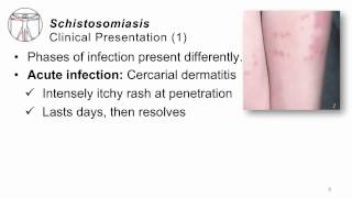 Treatment and Prevention  Schistosomiasis [upl. by Finkelstein]