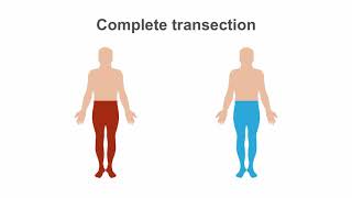 Spinal Cord Syndromes Clinical Recognition amp Anatomy Review [upl. by Lubba685]