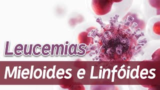 Leucemias Mieloides e Linfóides LMA LLA LMC LLC │ Patologia e Fisiopatologia [upl. by Salhcin330]