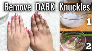 Lighten Dark Knuckles Naturally with 2 Home Remedies  Whiten Knees Elbow Ankle Tips Urdu Hindi [upl. by Eirellav779]