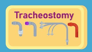 What is Tracheostomy [upl. by Lorrin]