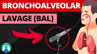 Mastering Bronchoscopy for Thoracic Surgery Chapter 2 [upl. by Coleen]