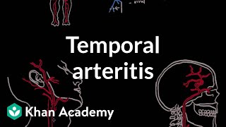 Temporal Pulse Point Palpation Location and Nursing Assessment [upl. by Ecar]